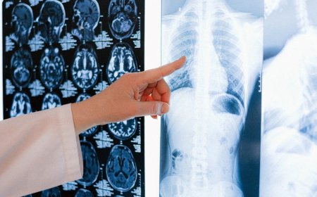 Opmerkelijke studie suggereert genezing van kanker met antiparasitaire middelen