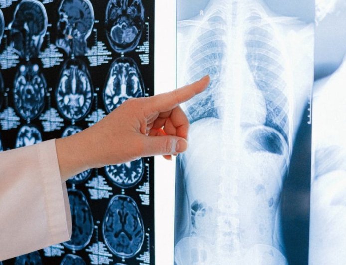 Opmerkelijke studie suggereert genezing van kanker met antiparasitaire middelen